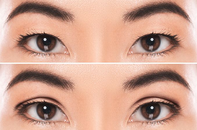 Double Eyelids | How to Get Double Eyelids | Multiple Ways (2021)